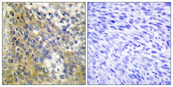 COL4A6 antibody