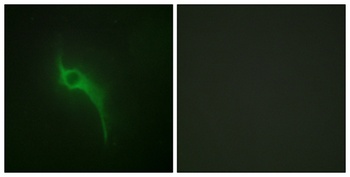 Collagen V antibody