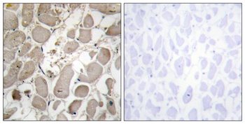 Collagen V antibody