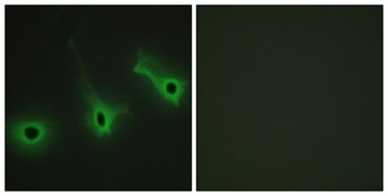 Collagen V antibody