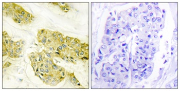 Collagen V antibody