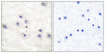 COT antibody