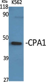 CPA1 rabbit pAb Antibody