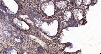 CRABP-II rabbit pAb