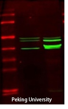 Creatine Kinase M antibody