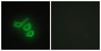 Creatine Kinase M antibody