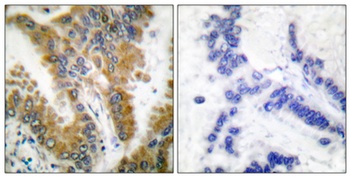 Crk-L antibody