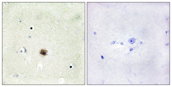 CRP1 rabbit pAb