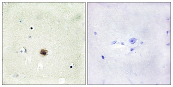 CRP1 antibody