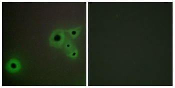 CRSP130 antibody