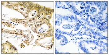 CRSP130 antibody