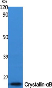 Crystallin-αB rabbit pAb