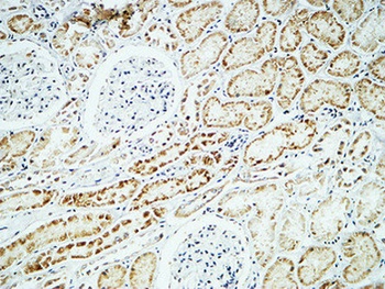 Crystallin-alpha B antibody