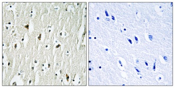 Csk antibody