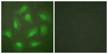 CSN3 antibody