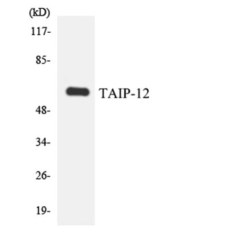 CSRNP2 rabbit pAb