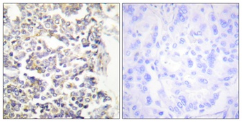 C-TAK1 antibody