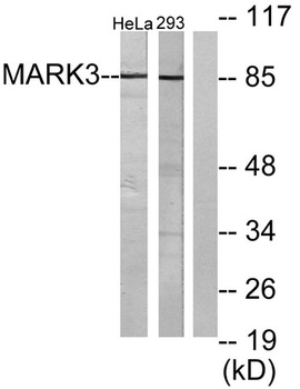 C-TAK1 antibody