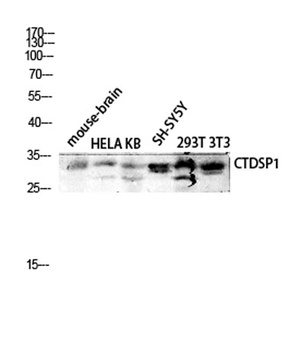 CTDSP1 antibody