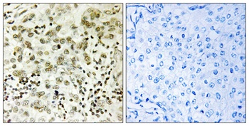 CTDSP1 rabbit pAb