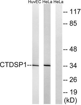 CTDSP1 rabbit pAb