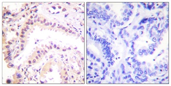 CUL-2 rabbit pAb