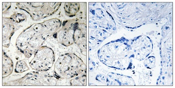 CYB5R3 antibody