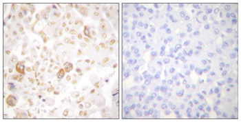 Cyclin F antibody