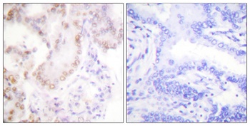Cyclin G rabbit pAb Antibody