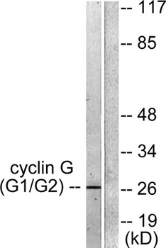 Cyclin G rabbit pAb Antibody