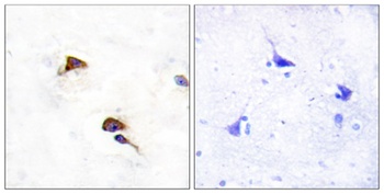 Cyclophilin F antibody