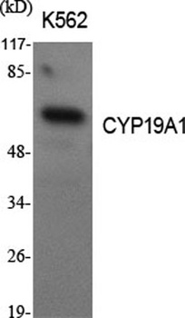 CYP19A1 rabbit pAb