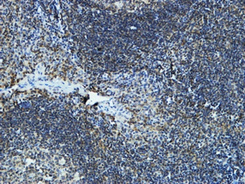 CYP19A1 rabbit pAb