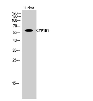 CYP1B1 rabbit pAb