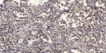 CYP27A1 rabbit pAb