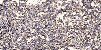 CYP27A1 antibody