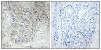 CYP2D6 rabbit pAb Antibody