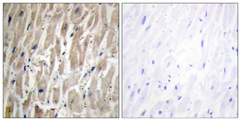 CYP2J2 rabbit pAb