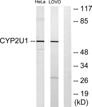 CYP2U1 rabbit pAb