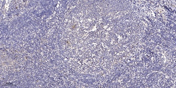 CYP2U1 rabbit pAb