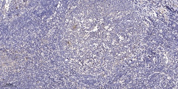 CYP2U1 antibody