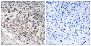 CYP2W1 rabbit pAb
