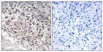 CYP2W1 antibody