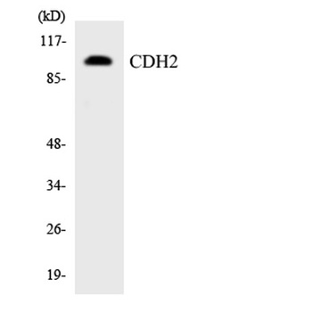 CYP2W1 antibody