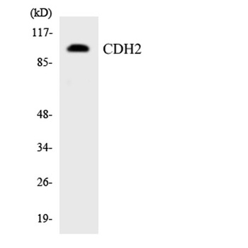 CYP2W1 rabbit pAb