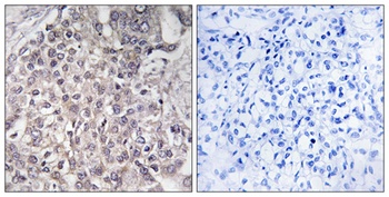 CYP4F2 rabbit pAb