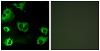 CysLTR1 antibody