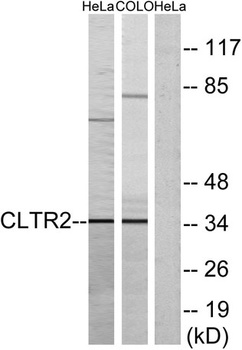CysLTR2 rabbit pAb