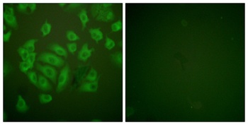 Cystatin A rabbit pAb