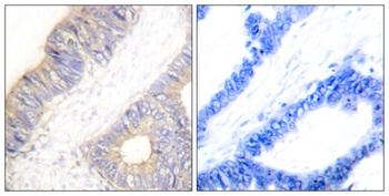 Cystatin A rabbit pAb